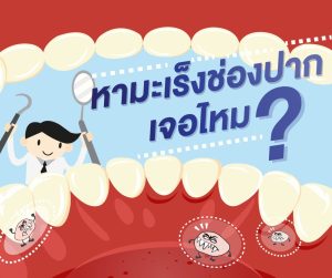 Fact sheet: การประเมินความเป็นไปได้ของมาตรการตรวจคัดกรองมะเร็งช่องปากในชุมชน